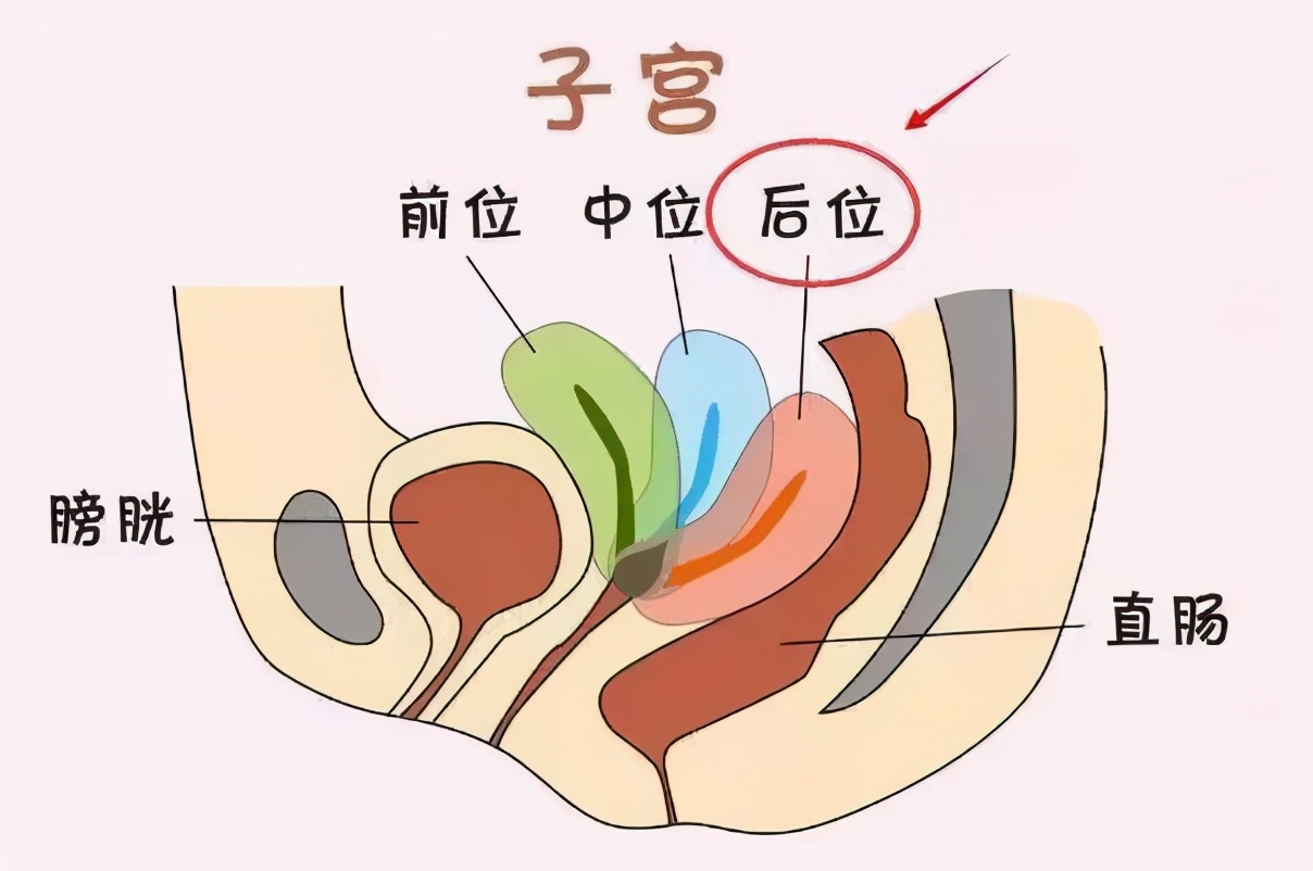 子宫后位对怀孕有影响吗？速速get子宫后位的备孕技巧