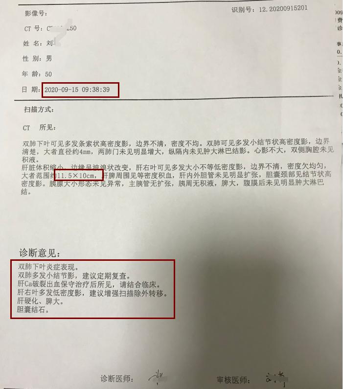 肝癌肿瘤破裂出血会越来越频繁吗,肝癌肿瘤破裂出血能止住吗