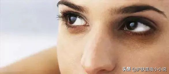 有黑眼圈如何不用护肤品快速消除,去黑眼圈最有效的方法护肤