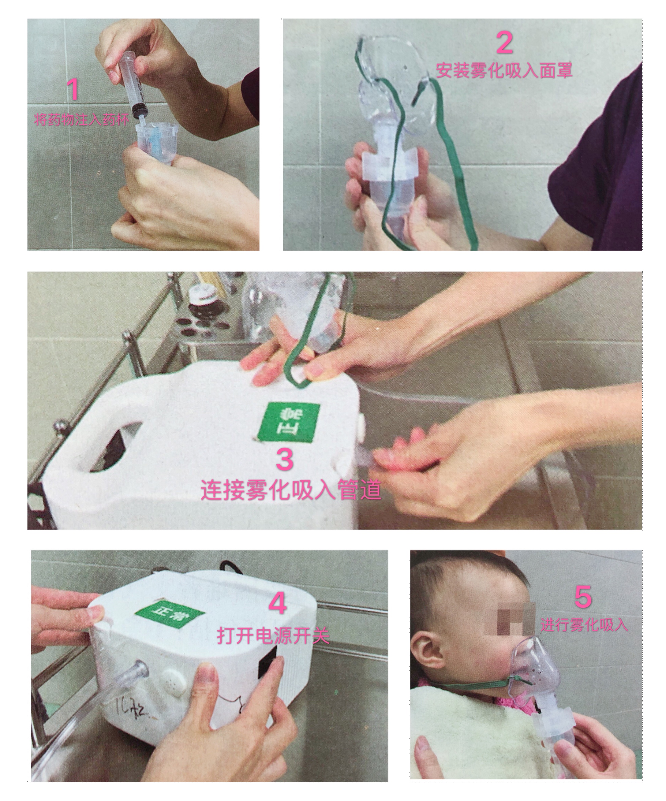 儿童咳嗽有痰雾化吸入用什么药,宝宝咳嗽雾化最少要做几天