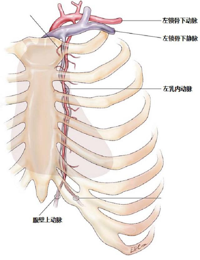 做完搭桥手术后,心绞痛能立即缓解吗?以后还会出现吗?
