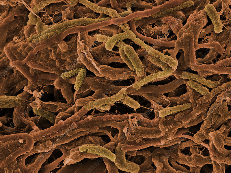 海底400度火山口的虾上岸,生活在海底温度最高的虾