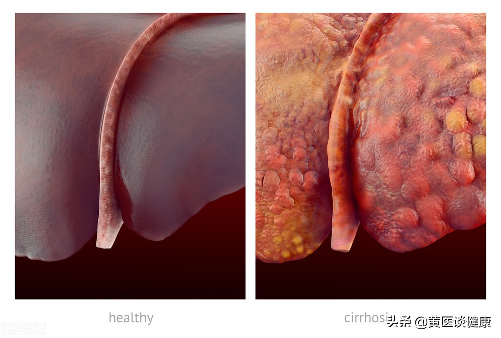 小三阳病毒携带者肝功能低于500,小三阳肝功能正常需要抗病毒