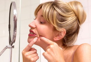 自己爆掉的痘痘要涂什么药,痘痘是挤出来好还是自然消退好