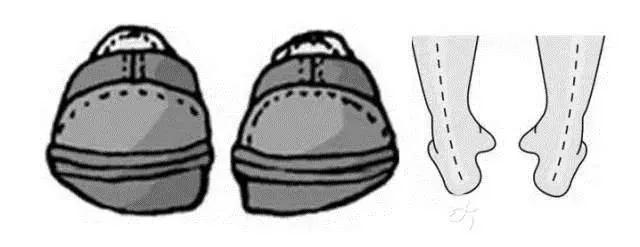 走路磨鞋底怎么回事,走路老是磨鞋怎么解决