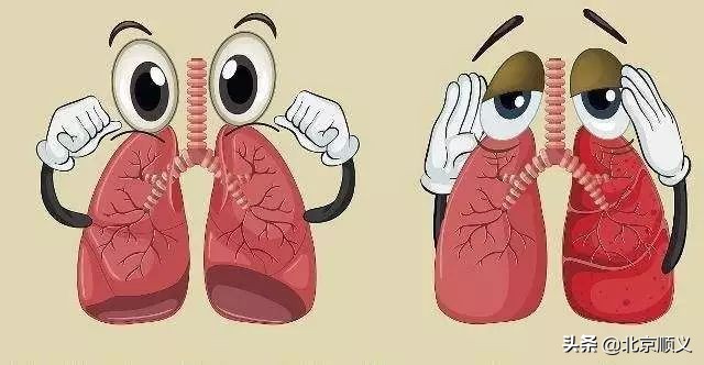 最近孩子一咳嗽就发高烧,孩子咳嗽有炎症高烧需要输液吗