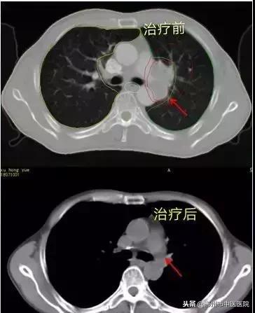 死神推我走陀螺拖我回