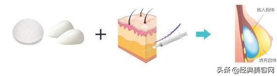 最简单的丰胸训练方法,平胸丰胸最有效的方法