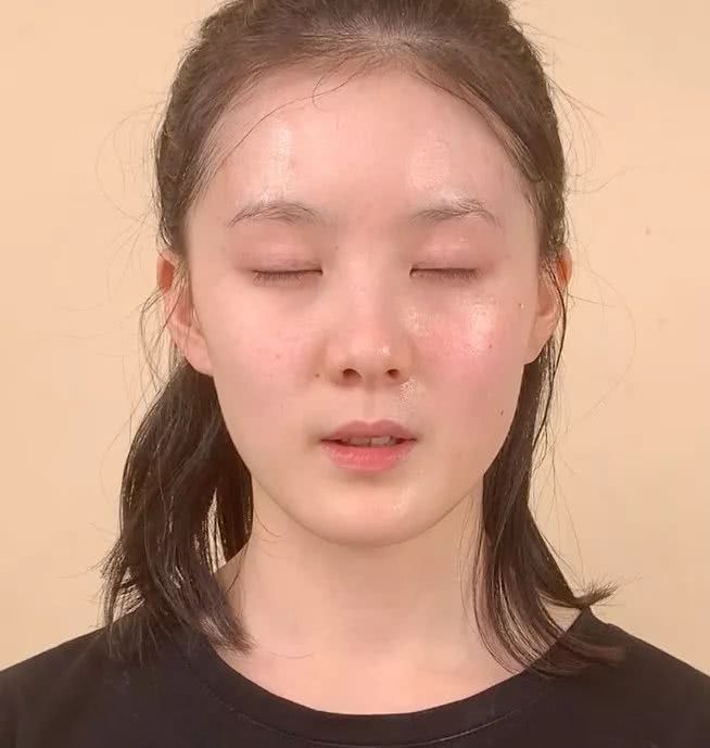 做了微整之后的感悟,微整经验