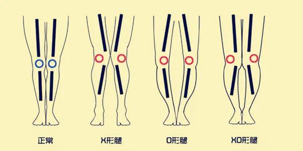 5天极速改善腿型,15天改善腿型的动作