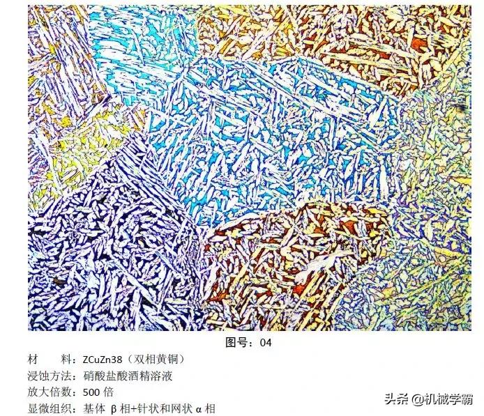 马氏体、奥氏体、珠光体，20种材料彩色金相，带你轻松识别