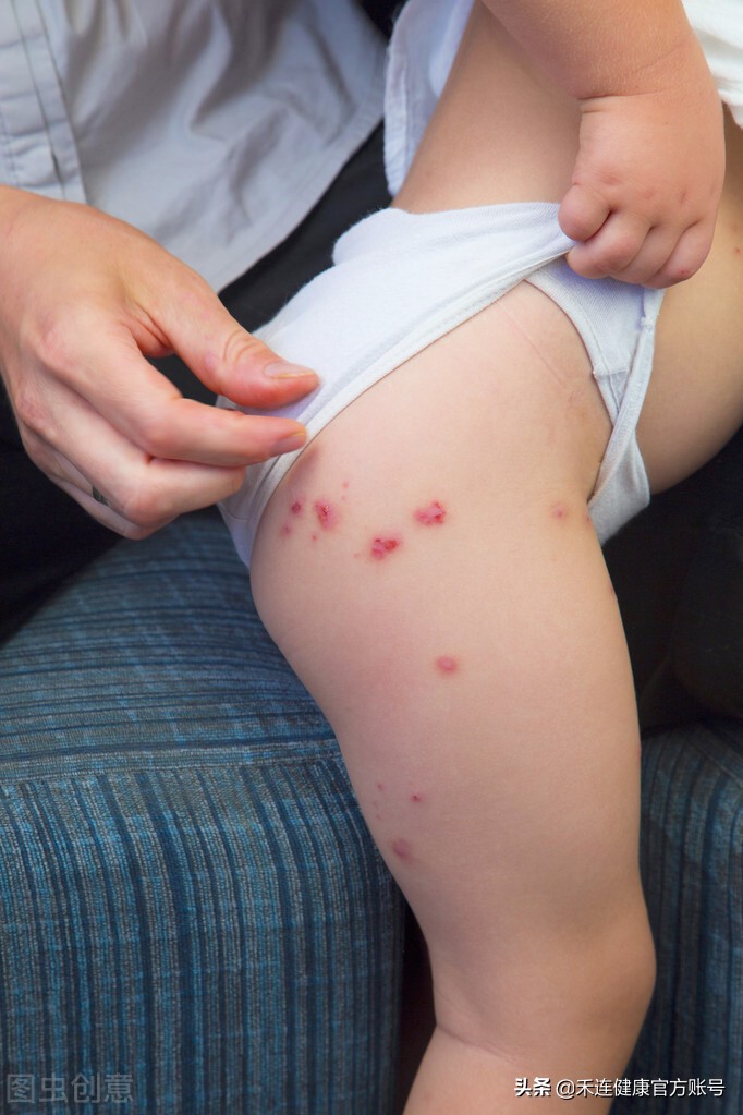 身上出现小红点是肝出现问题了吗,身上有小红点跟肝有关系吗