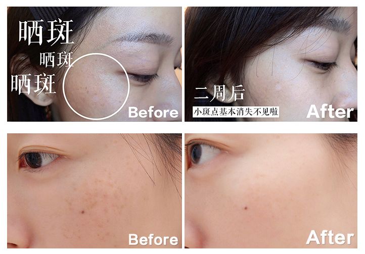 用了很多护肤品还是不白,白月光护肤品哪个更提亮皮肤