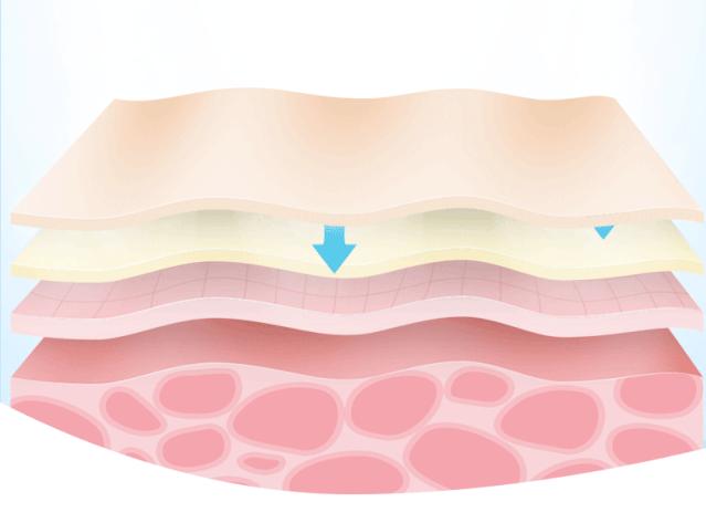 痘印很顽固怎么祛痘印,痘印祛痘药膏