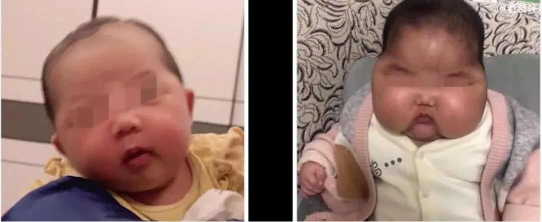 提前发育的孩子要注意什么,如何正确认识孩子提前发育