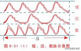 迟脉的脉象和主病大全,缓脉和涩脉有什么症状