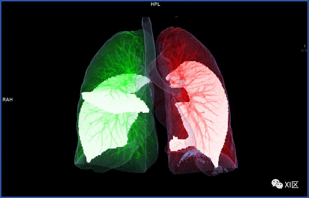 如此详细的肺部影像解剖，有点儿酷！