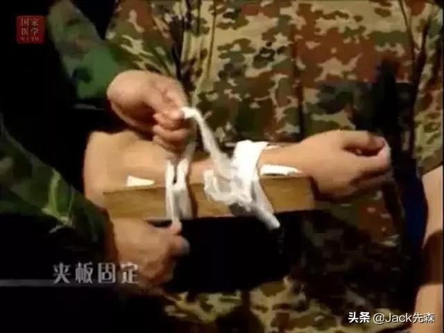 安全知识户外骨折急救护理常识,骨折急救培训知识