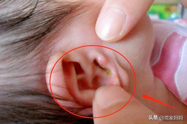 新生儿怎么护理好一点,新生儿宝宝护理常见的误区