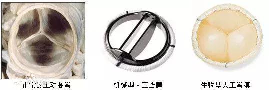 华法林的用途及副作用,服用华法林初期inr控制范围