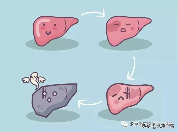 肝肿瘤甲胎蛋白升高怎么回事,afp甲胎蛋白偏高0.6怎么处理