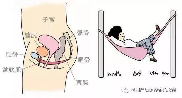 产后盆底肌会导致漏尿吗,盆底肌漏尿治疗有用吗