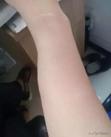 台风来了海岸上很多虫子,台风后出现的虫子