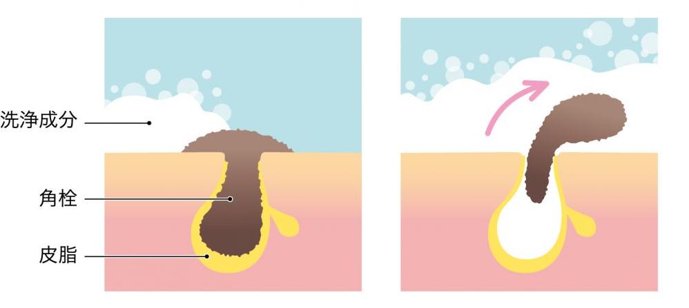 毛孔粗大收缩毛孔哪款爽肤产品好,毛孔粗大收缩毛孔最有效的产品