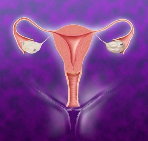 真菌性妇科炎症是什么原因造成的,得妇科炎症的主要原因是