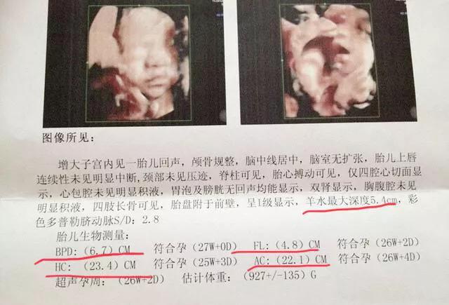 胎儿健康程度做什么检查,怎样能看出胎儿是否健康