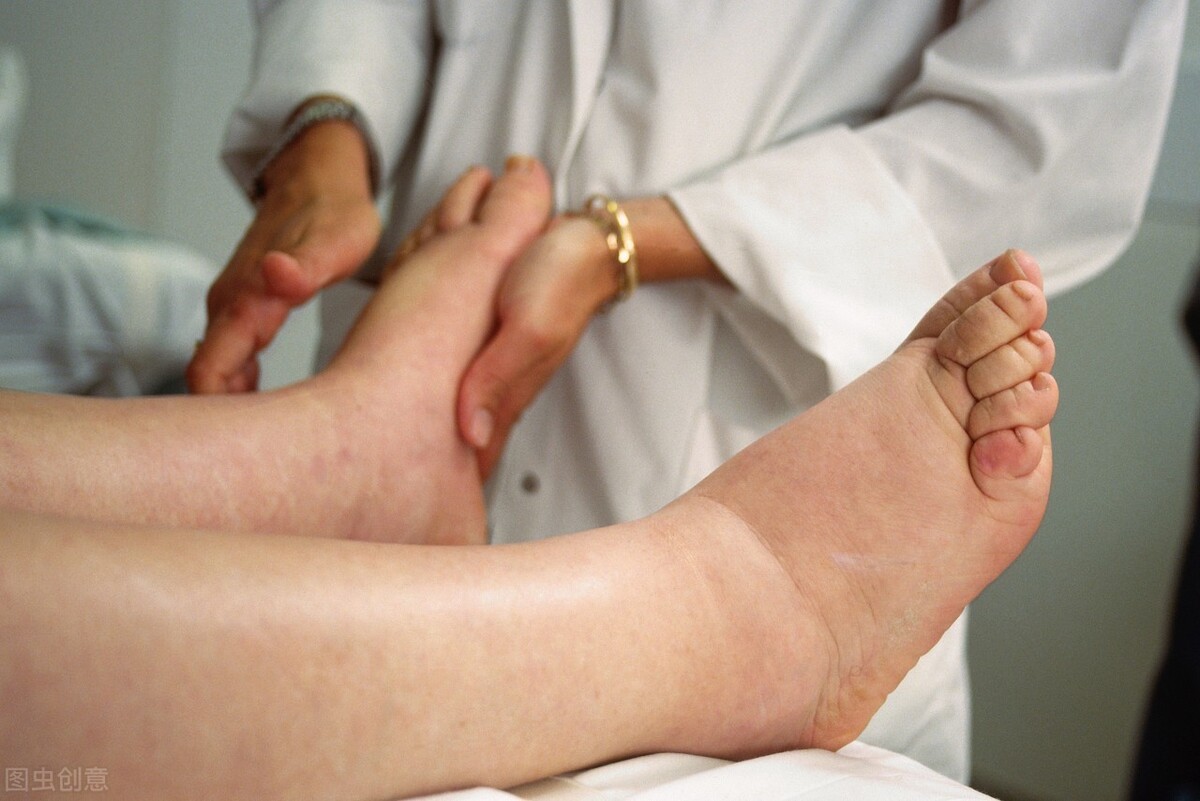 肾病用利妥昔副作用,肾病用利妥昔单抗前都做什么检查