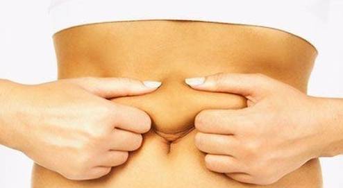 肥胖纹和妊娠纹消除方法,肥胖纹妊娠纹怎么消除