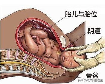 专家说生孩子得趁早,过来人说生孩子很容易