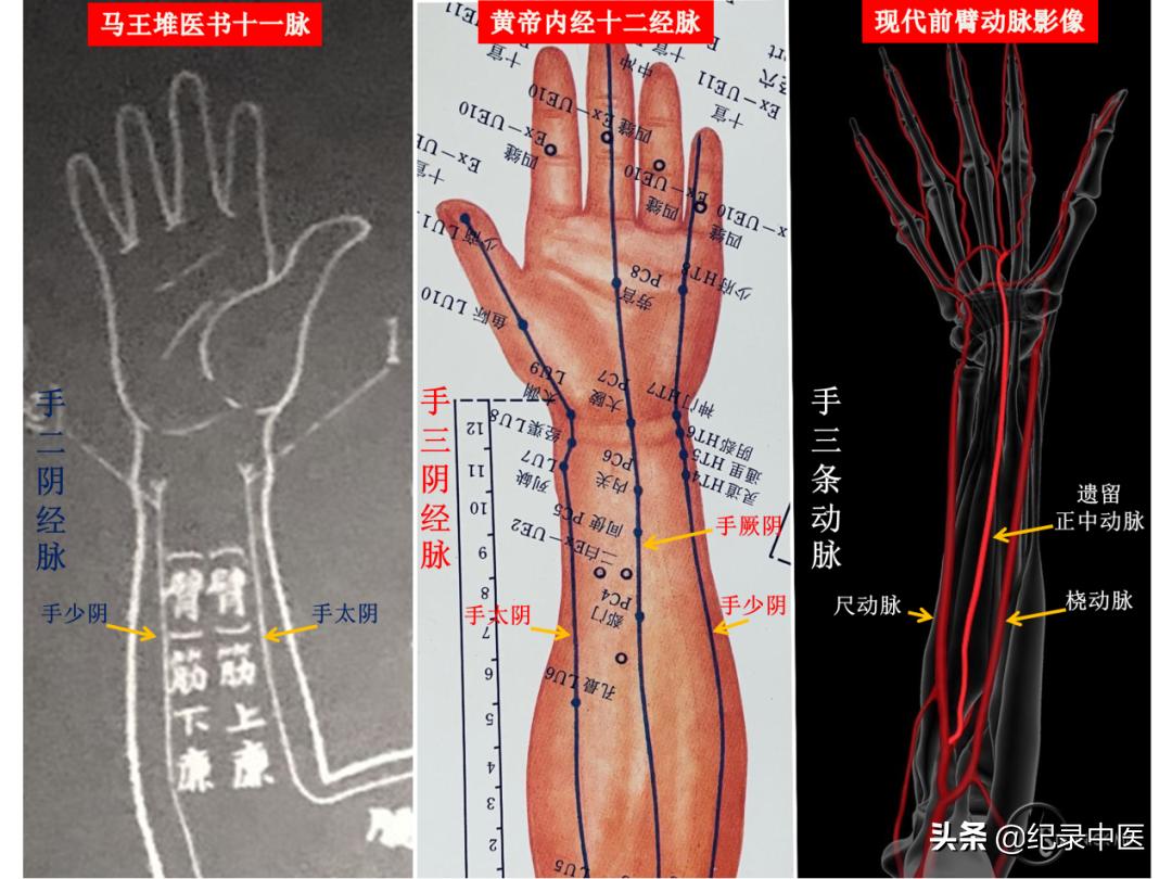 经络真的存在吗,真实存在的经络