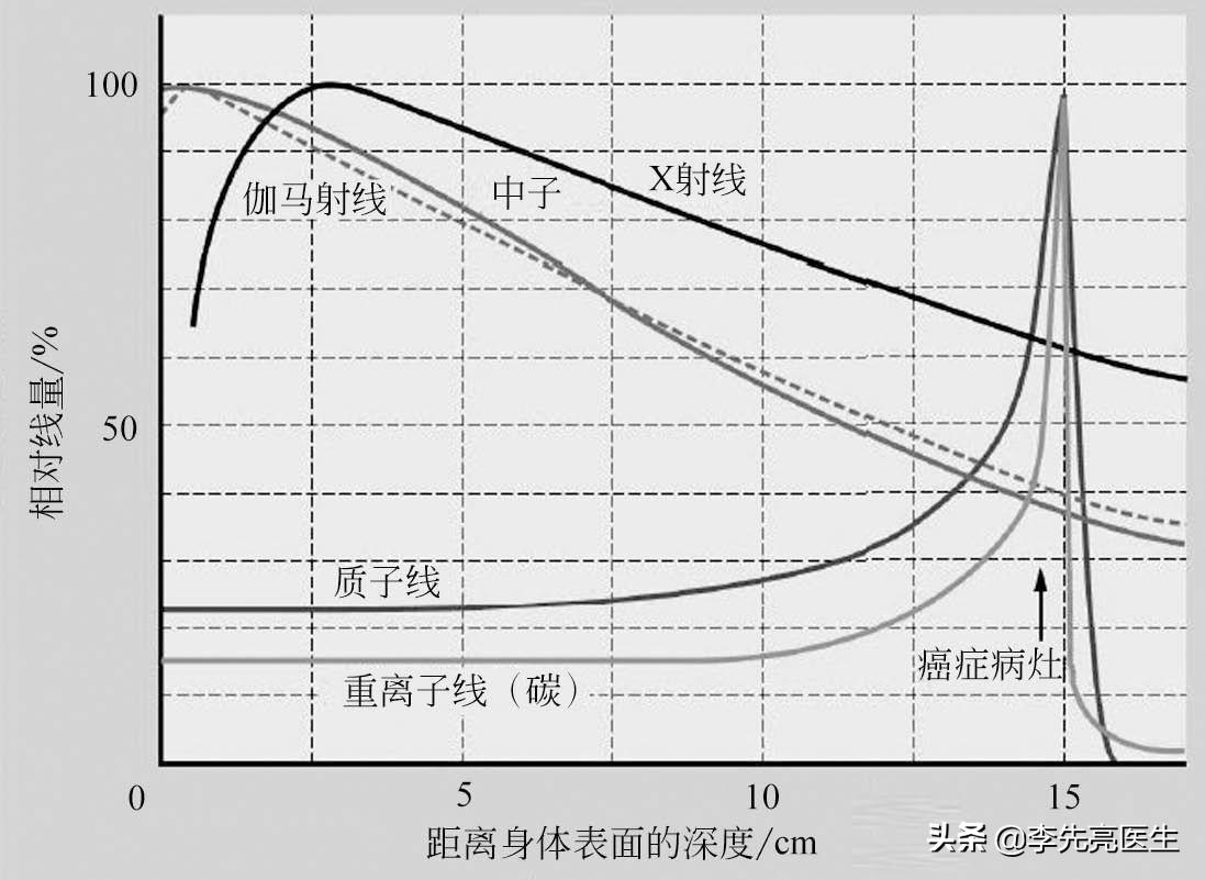 质子重离子能治癌转移吗,治癌利器质子重离子