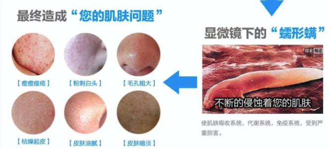 生活中常见的致命毒虫,澳洲常见的几种虫子