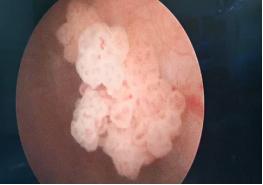 山东治疗泌尿外科比较好的医院,山东大学附属医院泌尿外科专家