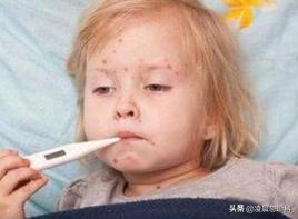 宝宝长水痘怎么处理好得快,小孩子水痘要是没发好会怎么样