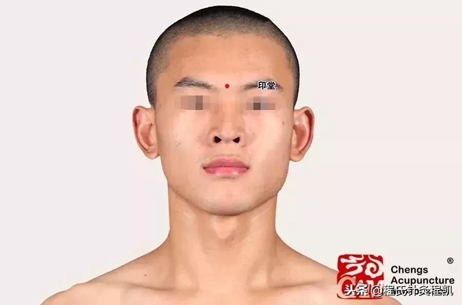 经络养生助睡眠,经络疏通促进血液循环助睡眠