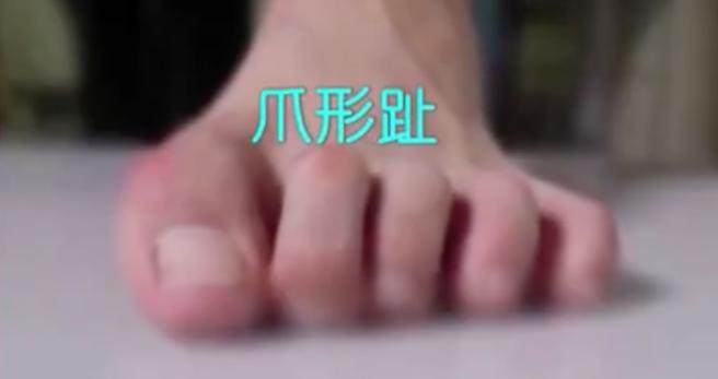 怎样选一款适合自己脚型的鞋,适合大脚骨穿的鞋测评