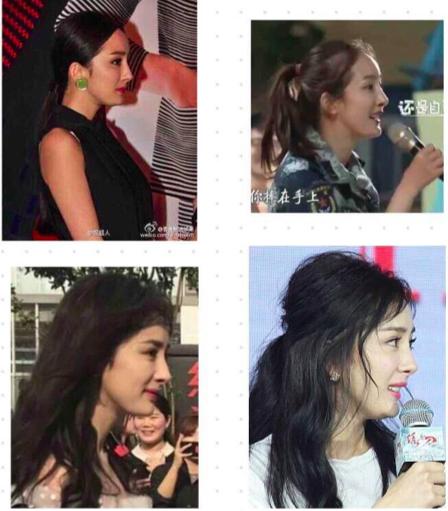 杨幂这些整容后遗症告诉你，不断返厂重修，代价得不偿失