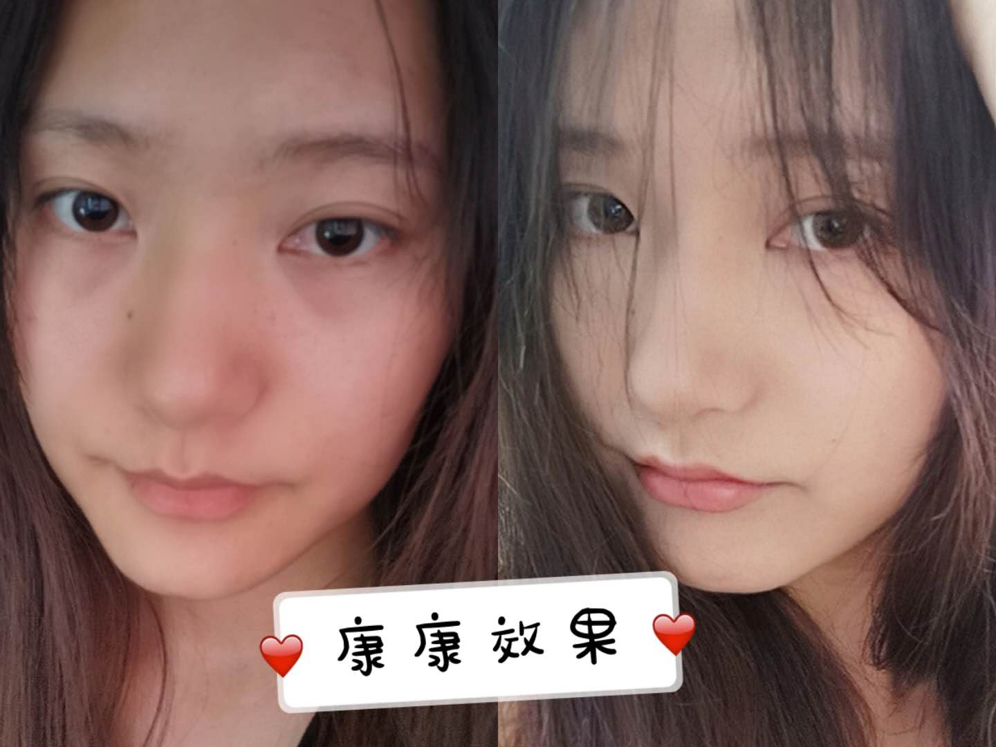 什么颜色遮黑眼圈泪沟比较自然,遮严重的黑眼圈泪沟的教程