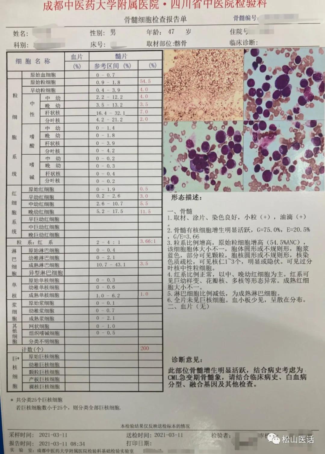 良性肿瘤靶向治疗方法,中医靶向治疗恶性肿瘤
