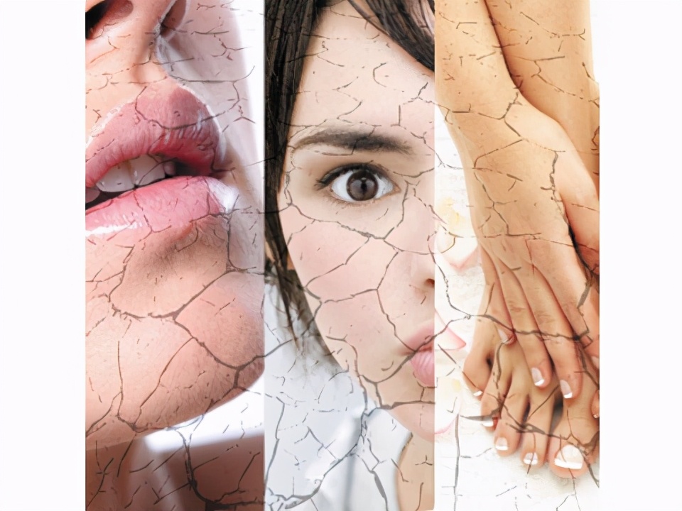 皮肤干保湿的正确方法,皮肤特别干怎么用面霜快速补水