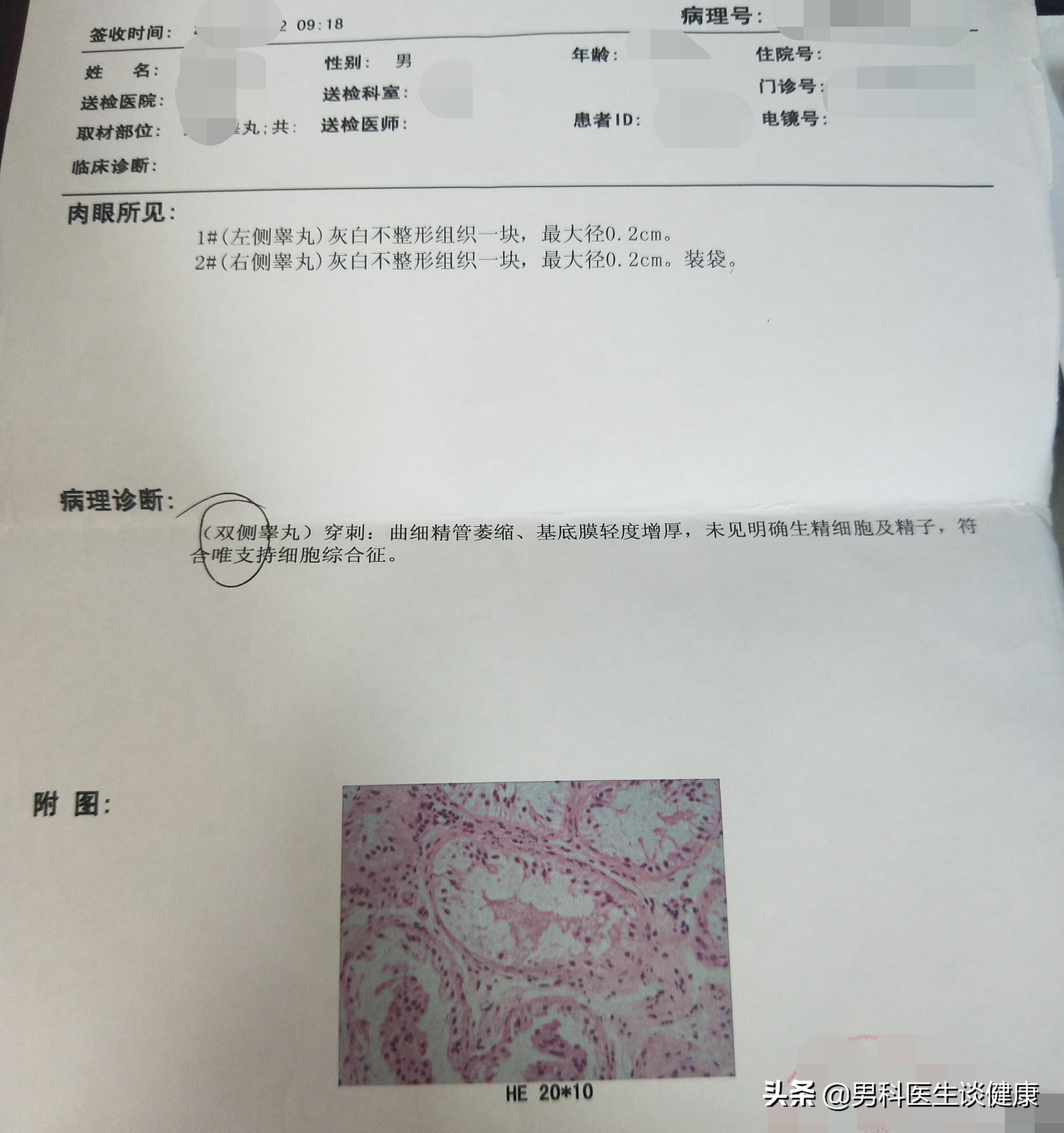 唯细胞支持综合征是先天的吗,唯细胞支持综合征有几率怀孕吗