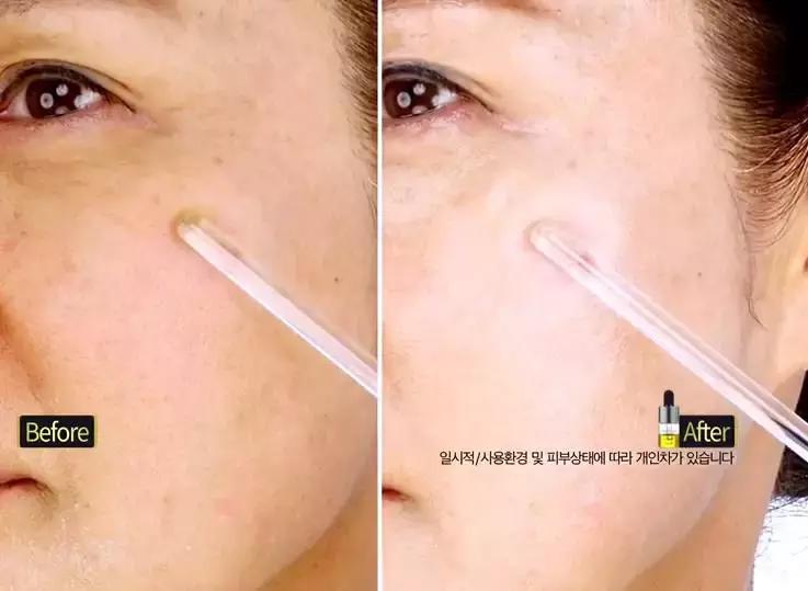 明星童颜秘诀，每1秒卖出10瓶的TA，素人高呼有效淡纹、去暗沉！