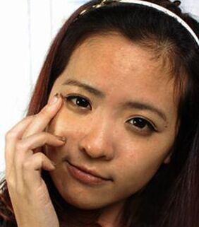 青春期女生毛孔特别粗大,20岁女人毛孔粗怎么办