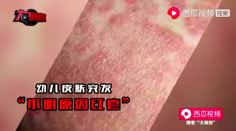 湖南把饮料当奶粉喝出大头娃娃 (湖南大头娃娃假奶粉事件)