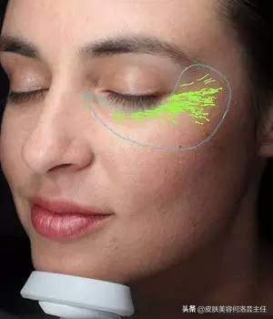 visia皮肤检测仪,visia皮肤检测报告数值越大越好吗