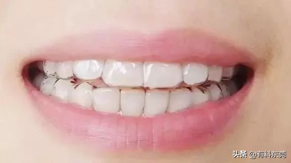 28.8元超声波洁牙！超值88折！让茶山人轻松实现...